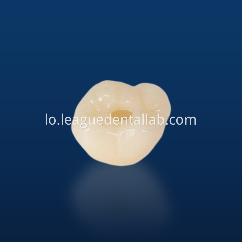 ເຮືອນຍອດ Implant ແຂ້ວ Dental Implant Crown